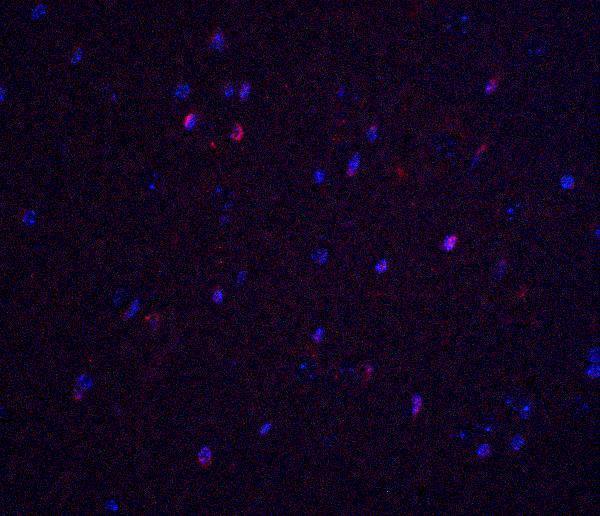 Immunofluorescence of TNFAIP1 in mouse brain tissue with TNFAIP1 antibody at 20 μg/ml