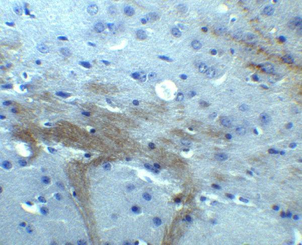 Immunohistochemistry of TNFAIP1 in mouse brain tissue with TNFAIP1 antibody at 10 μg/ml