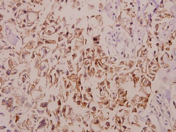 a06143s122 tnfaip1 primary antiboties ihc testing 2