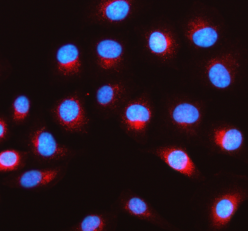 a06146 amd1 primary antibodies if testing 1
