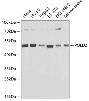 Western blot analysis of extracts of various cell lines, using POLD2 antibody  at 1:1000 dilution