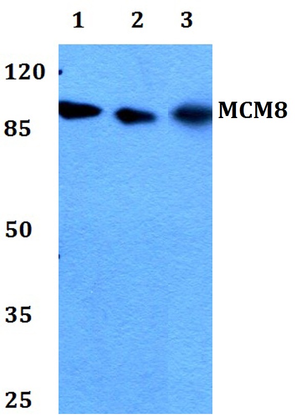 Western blot (WB) analysis of MCM8 polyclonal antibody at 1:500 dilution
Lane1:HEK293T whole cell lysate
Lane2:Raw264