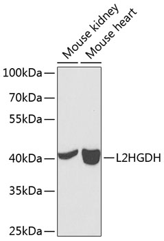 Western blot analysis of extracts of various cell lines, using L2HGDH antibody  at 1:1000 dilution