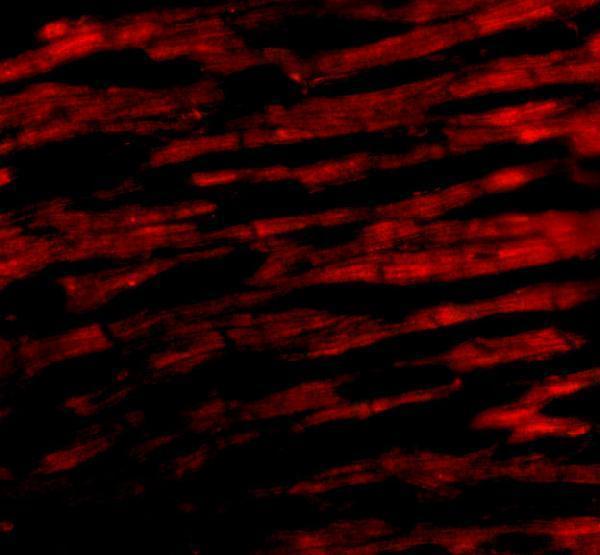 Immunofluorescence of Bcl-rambo in Human Heart cells with Bcl-rambo antibody at 20 μg/mL