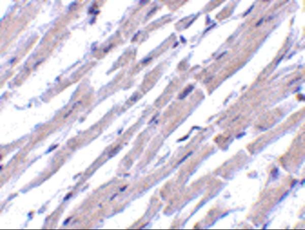 Immunohistochemistry of Bcl-rambo in human heart tissue with Bcl-rambo antibody at 10 μg/mL
