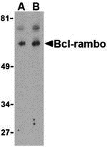 Western blot analysis of Bcl-rambo in K562 cell lysate with Bcl-rambo antibody at (A) 2 and (B) 4 μg/mL