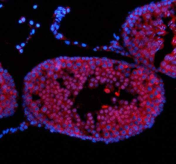 IF analysis of NUP50 using anti-NUP50 antibody (A06152-1)