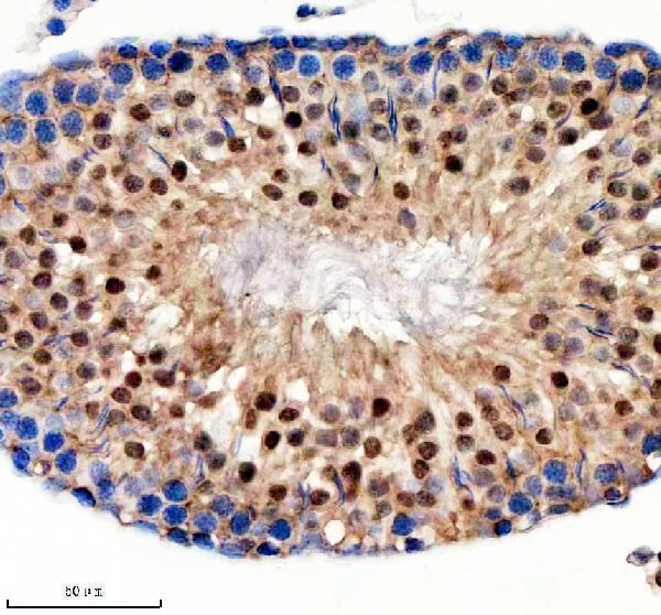 IHC analysis of NUP50 using anti-NUP50 antibody (A06152-1)