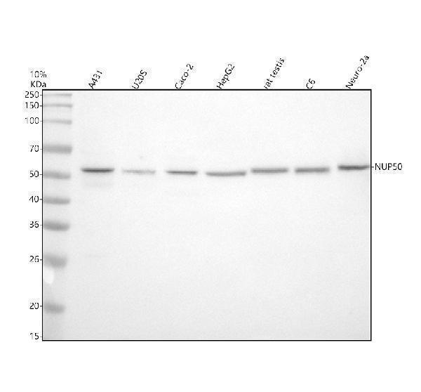 Western blot analysis of NUP50 using anti-NUP50 antibody (A06152-1)