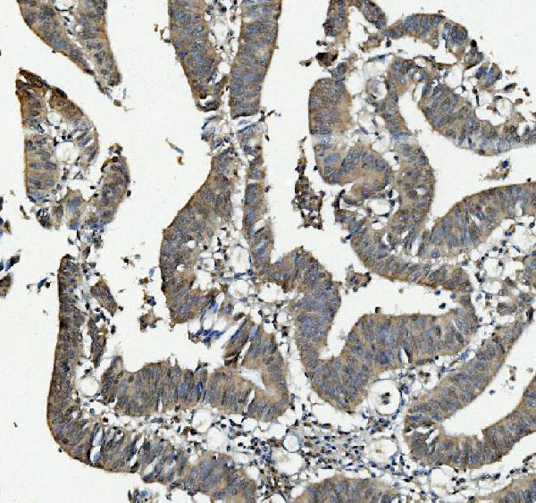 a06153 1 anapc2 primary antibodies ihc testing 3
