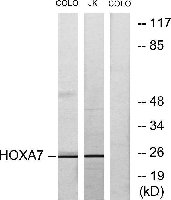 Western blot analysis of lysates from COLO205 and Jurkat cells, using HOXA7 Antibody