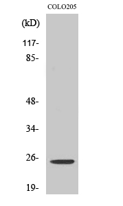 Western Blot analysis of various cells using Hox-A7 Polyclonal Antibody cells nucleus extracted by Minute TM Cytoplasmic and Nuclear Fractionation kit 