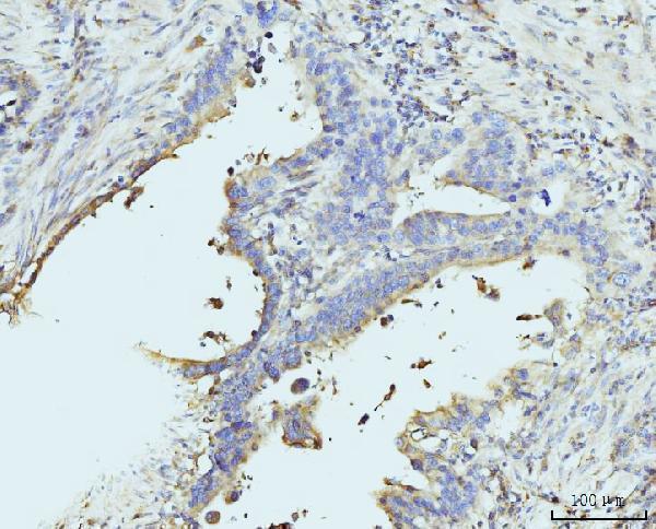  IHC analysis of RPL23 using anti-RPL23 antibody (A06155-2)