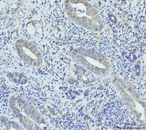  IHC analysis of RPL23 using anti-RPL23 antibody (A06155-2)