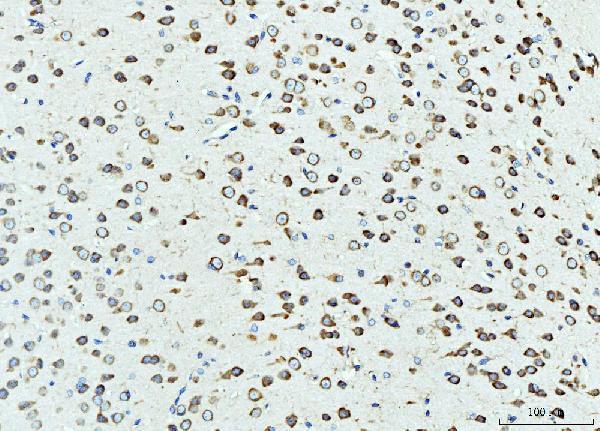 a06155 2 rpl23 primary antibodies ihc testing 5