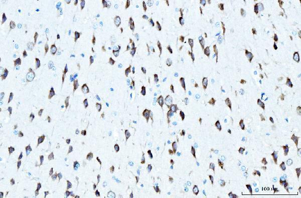 a06155 2 rpl23 primary antibodies ihc testing 6