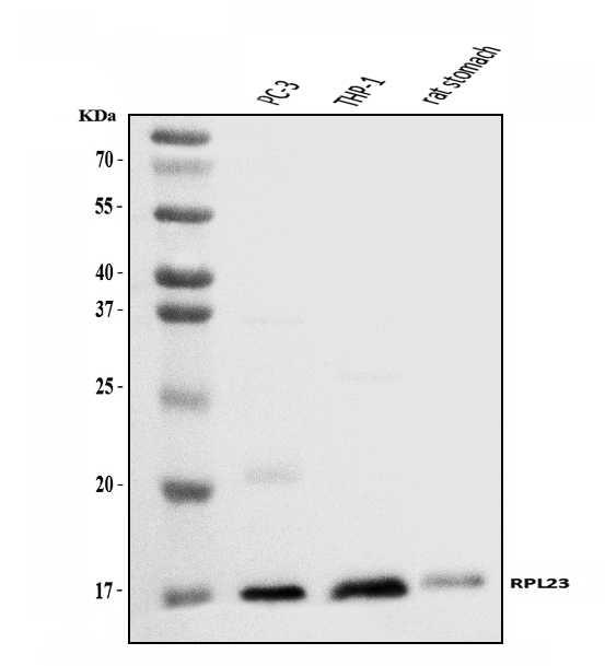  Western blot analysis of RPL23 using anti-RPL23 antibody (A06155-2)