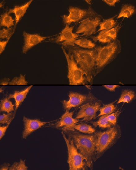 a06155 rpl23 primary antiboties if testing 4