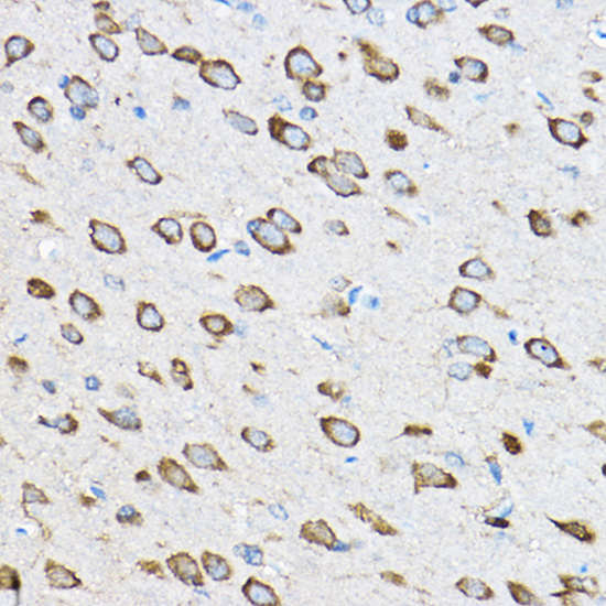 a06155 rpl23 primary antiboties ihc testing 2
