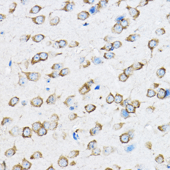 a06155 rpl23 primary antiboties ihc testing 3