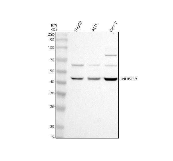Western blot analysis of TNFRSF19 using anti-TNFRSF19 antibody (A06157-1)