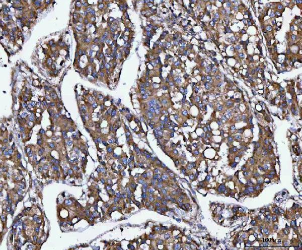  IHC analysis of MIA3 using anti-MIA3 antibody (A06158-1)