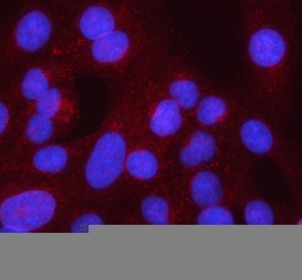 IF analysis of Syncoilin/SYNC using anti-Syncoilin/SYNC antibody (A06159-1)