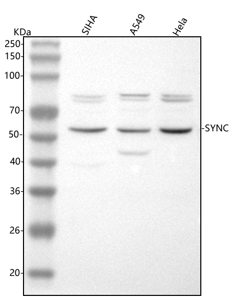  Western blot analysis of Syncoilin/SYNC using anti-Syncoilin/SYNC antibody (A06159-1)