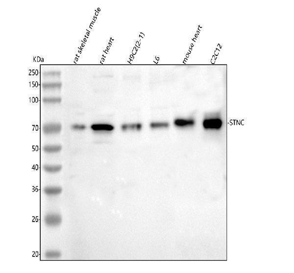  Western blot analysis of Syncoilin/Sync using anti-Syncoilin/Sync antibody (A06159-2)