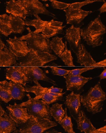 Immunofluorescence analysis of C6 cells using ITSN2 antibody  at dilution of 1:100