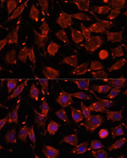 Immunofluorescence analysis of L929 cells using ITSN2 antibody  at dilution of 1:100