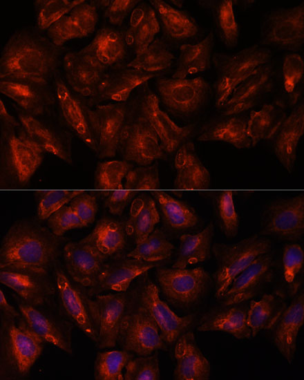 a06161 itsn2 primary antiboties if testing 4