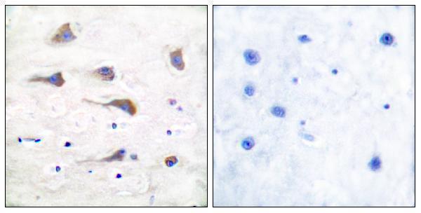 a06163 1 grm6 primary antibodies ihc testing 1