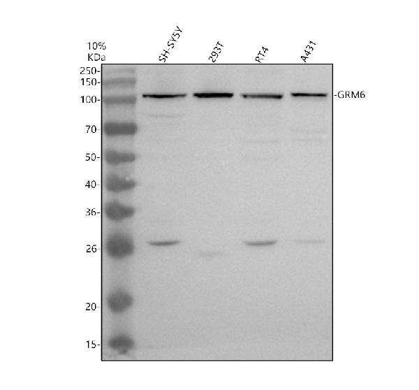 Western blot analysis of GRM6 using anti-GRM6 antibody (A06163-3)