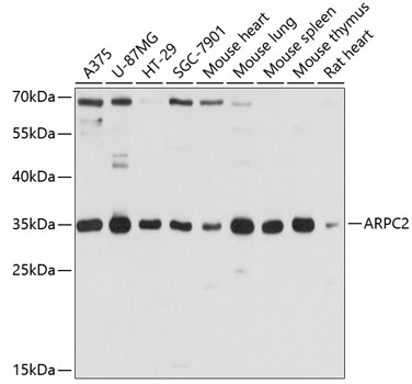 a06165 arpc2 primary antiboties wb testing 1
