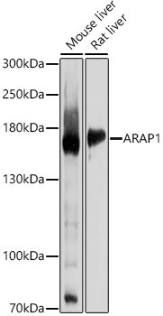 Western blot analysis of extracts of various cell lines, using ARAP1 antibody  at 1:1000 dilution