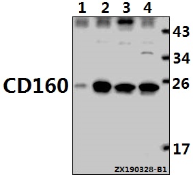 a06168t45 cd160 primary antiboties wb testing 1