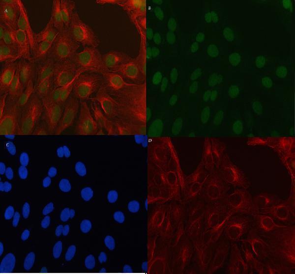  IF analysis of POGZ using anti-POGZ antibody (A06169-3) and anti-Beta Tubulin antibody (M01857-3)