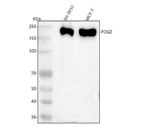  Western blot analysis of POGZ using anti-POGZ antibody (A06169-3)