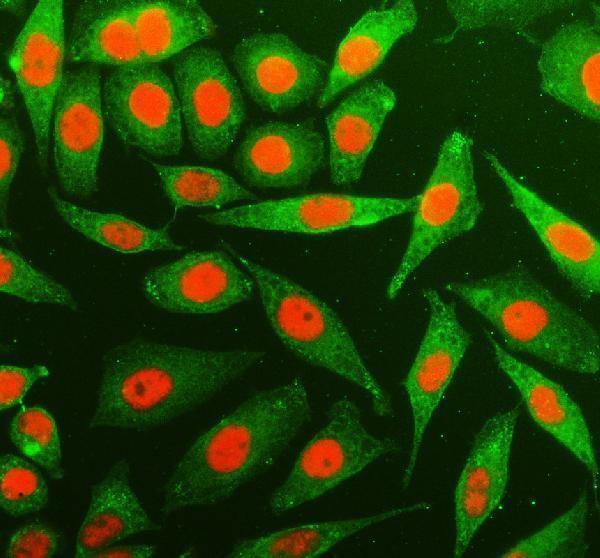 a06172 1 ythdc1 primary antibodies if testing 1