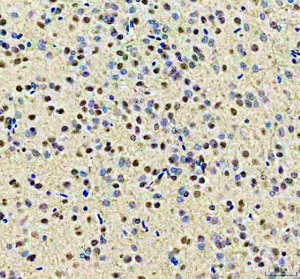 a06172 1 ythdc1 primary antibodies ihc testing 1