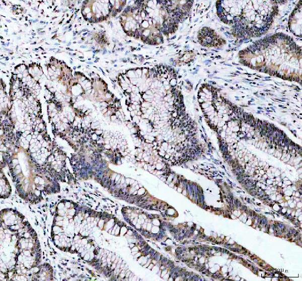 a06172 1 ythdc1 primary antibodies ihc testing 2