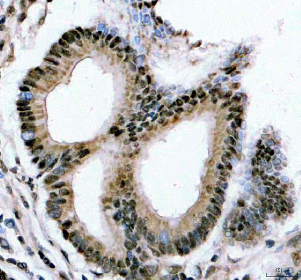 a06172 1 ythdc1 primary antibodies ihc testing 3