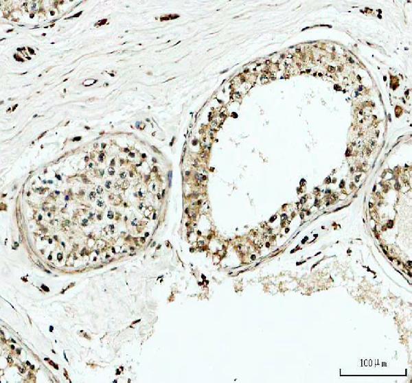 a06172 1 ythdc1 primary antibodies ihc testing 4