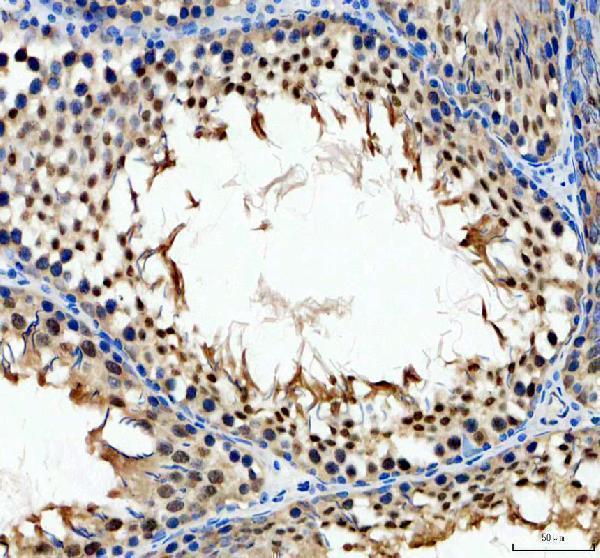 a06172 1 ythdc1 primary antibodies ihc testing 5