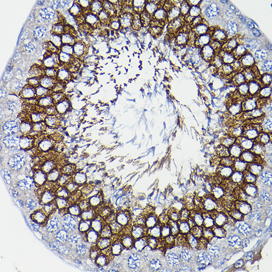 a06174 icmt primary antiboties ihc testing 3