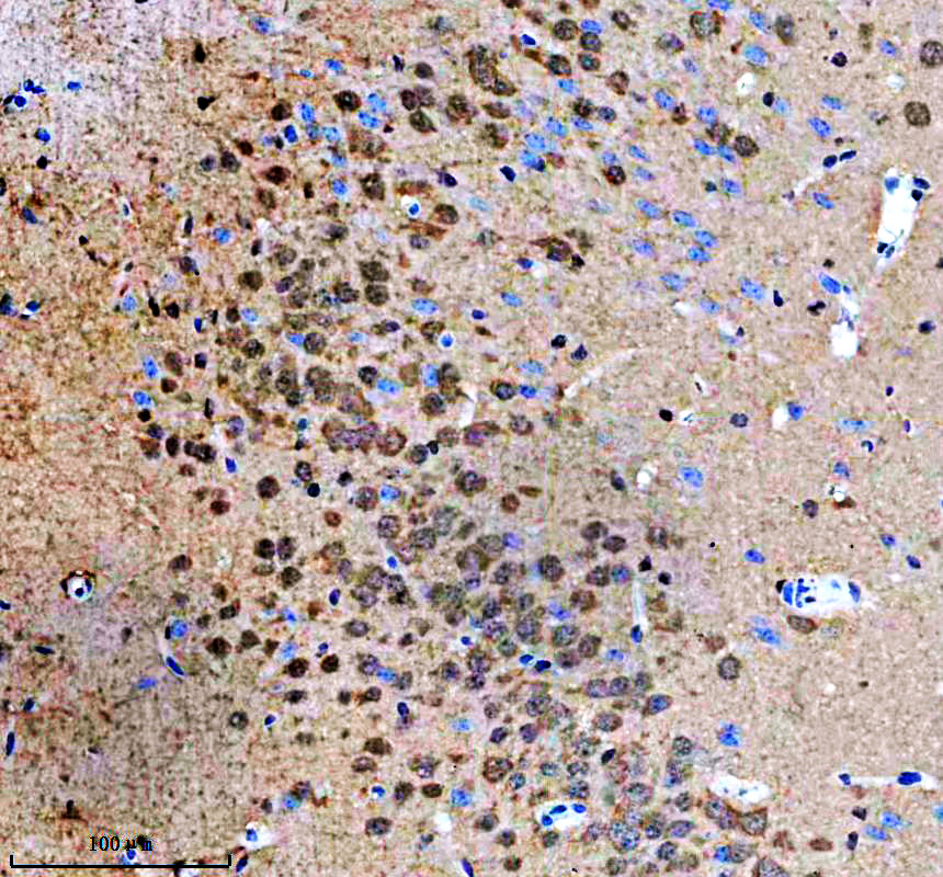 IHC analysis of KCNAB2 using anti-KCNAB2 antibody (A06176-1)