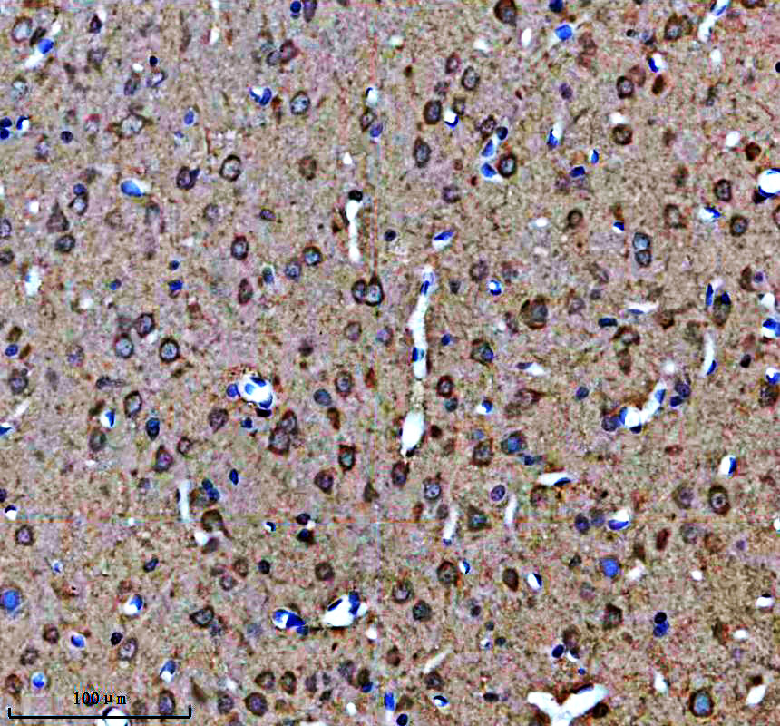 IHC analysis of KCNAB2 using anti-KCNAB2 antibody (A06176-1)