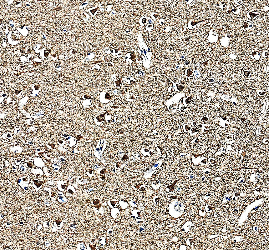 a06176 1 kcnab2 primary antibodies ihc testing 3