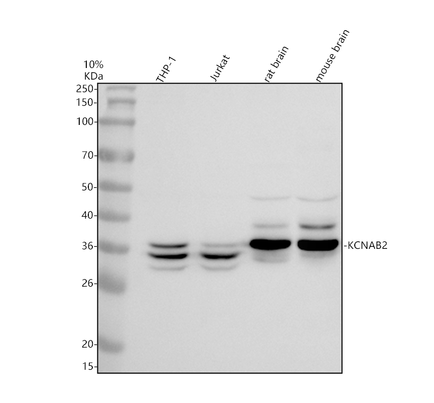 Western blot analysis of KCNAB2 using anti-KCNAB2 antibody (A06176-1)
